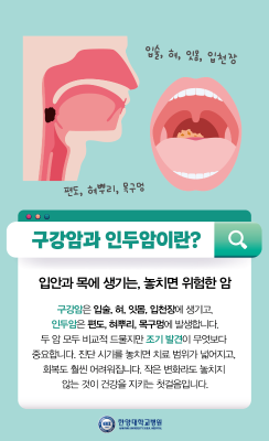 2주 이상 이어지는 입안 상처, 그냥 넘기지 마세요! '구강암, 인두암'